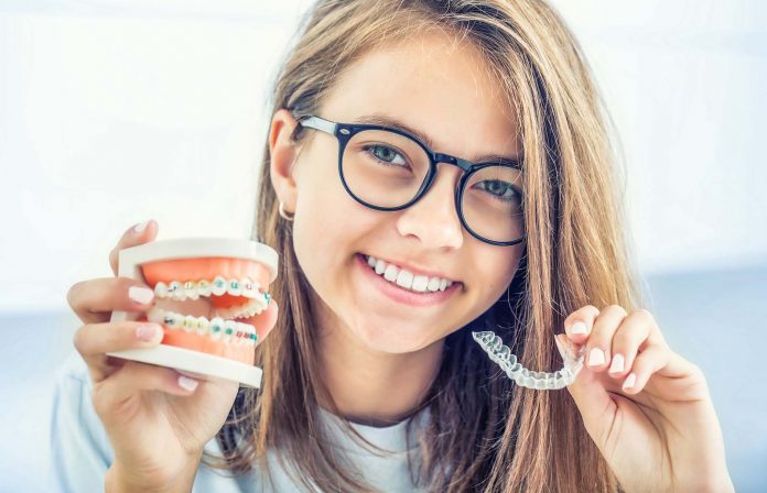 The Different Types of Braces and Orthodontic Treatment Options