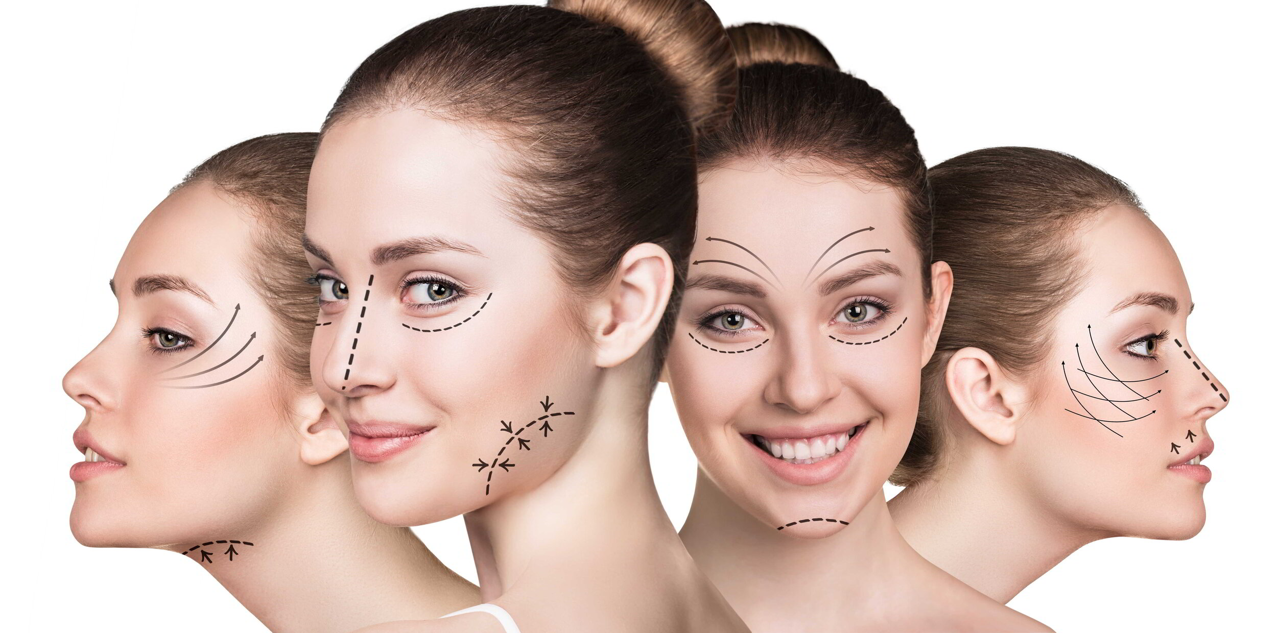 Botox and Dermal Fillers: Myths and Misconceptions Debunked